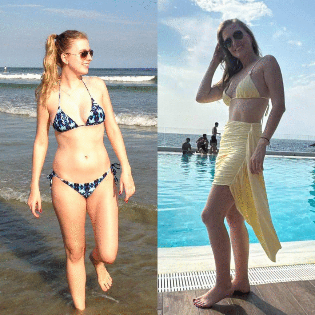 Giovanna, agente de importação, 33 anos, eliminou 5 kg em 2022 e mantém o resultado até hoje.