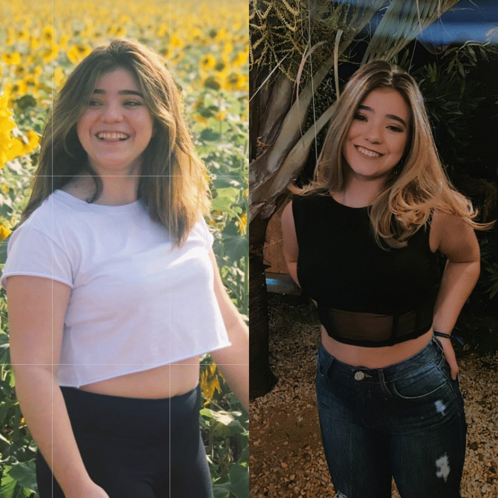 Maria, estudante de medicina, 20 anos, eliminou 10kg em 2021 e mantém o resultado até hoje.